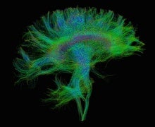 How Human Brains Are Different: It Has a Lot to Do with the Connections