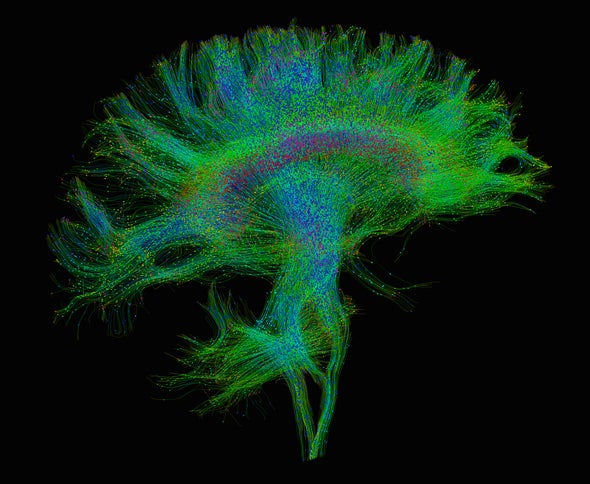 How Human Brains Are Different: It Has a Lot to Do with the Connections