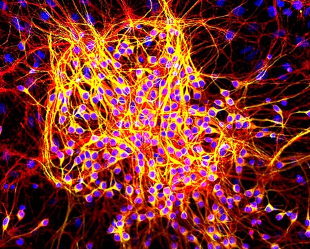 imagery of tau protein