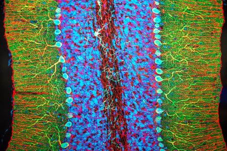 Purkinje细胞类型神经元,图片展示于展览《美脑:圣地亚哥拉蒙-卡哈尔画像