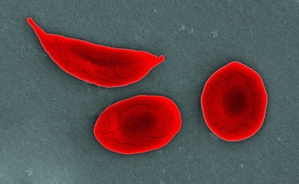 Two quasi-circular red cells plus a third, shaped more like a crescent moon.
