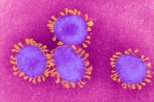 Disease Caused by the Novel Coronavirus Officially Has a Name: Covid-19
