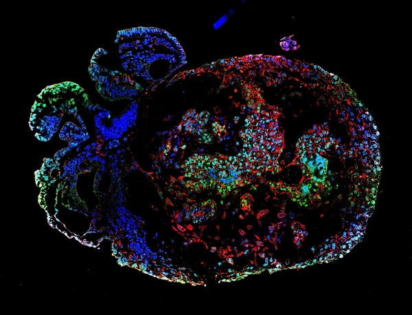 25-day-old monkey embryo stained with fluorescent dyes (multicoloured).