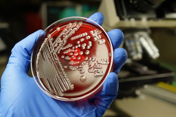 Petri dish with E. coli bacteria
