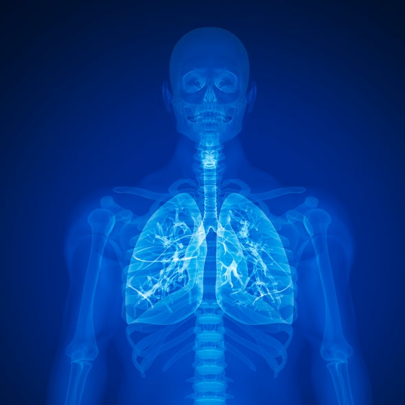 Sensors Save Lung Transplant Patients from Organ Failure