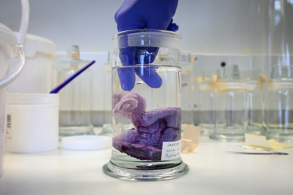 A Psychropotes Longicauda sea cucumber is seen as it is transferred with purple gloves into an ethanol-filled specimen jar for scientific preservation