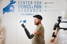 Above-Elbow Bionic Arm Can Control Every Finger