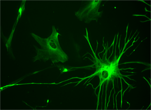 Mice Show Signs of Mental Disorder after Injections of Cells from Schizophrenia Patient