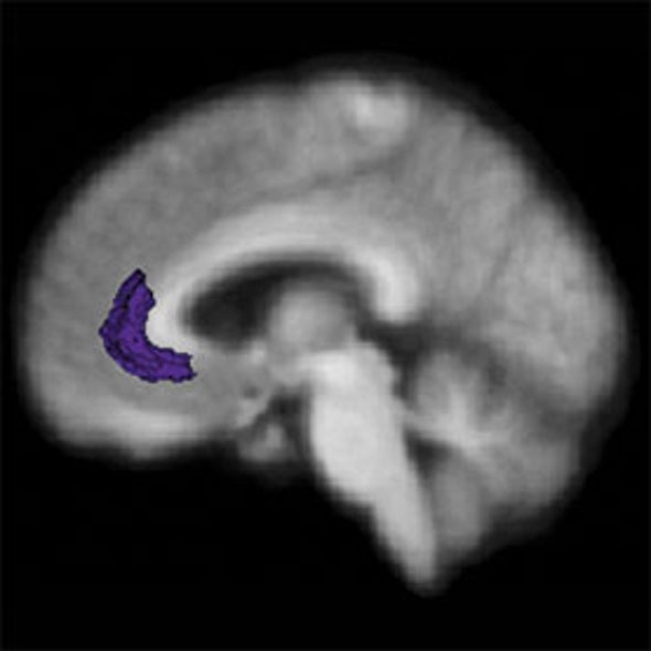 How Embarrassing: Researchers Pinpoint Self-Consciousness in the Brain