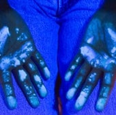Fluorescent Hands: