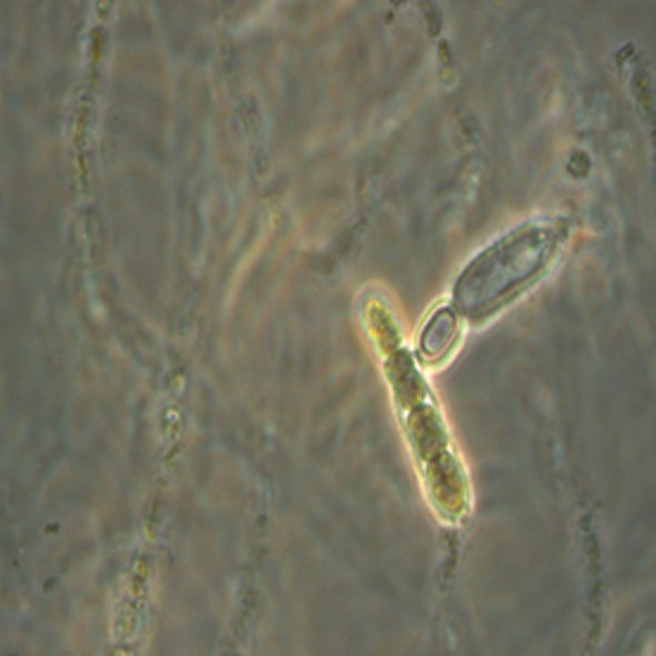 Bugs In Space Scientific American Bugs In Space Scientific American