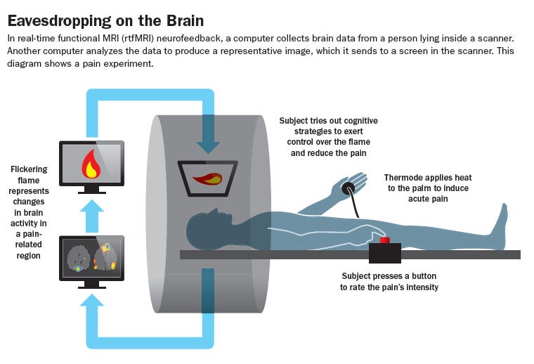 Fmpir Mri Sequence