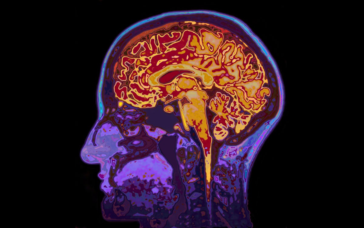 Take our quiz - Think Brain Health - Alzheimer's Research UK