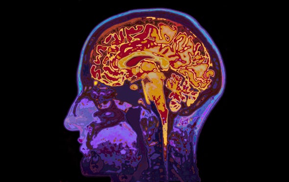 Forgotten Memories of Traumatic Events Get Some Backing from Brain-Imaging Studies