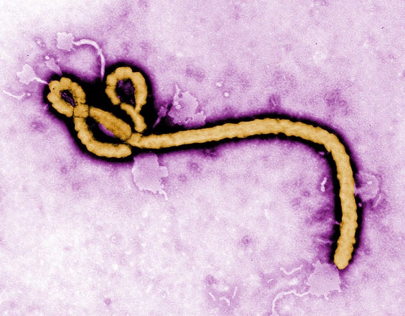 U.K. Nurse with Serious Ebola Complications Has Meningitis Caused by Persisting Virus